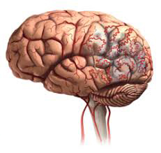 Section of brain damage in a stroke
