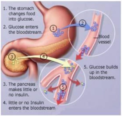 ECP benifits in Diabetes