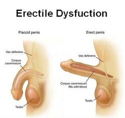 Erectile dysfunction